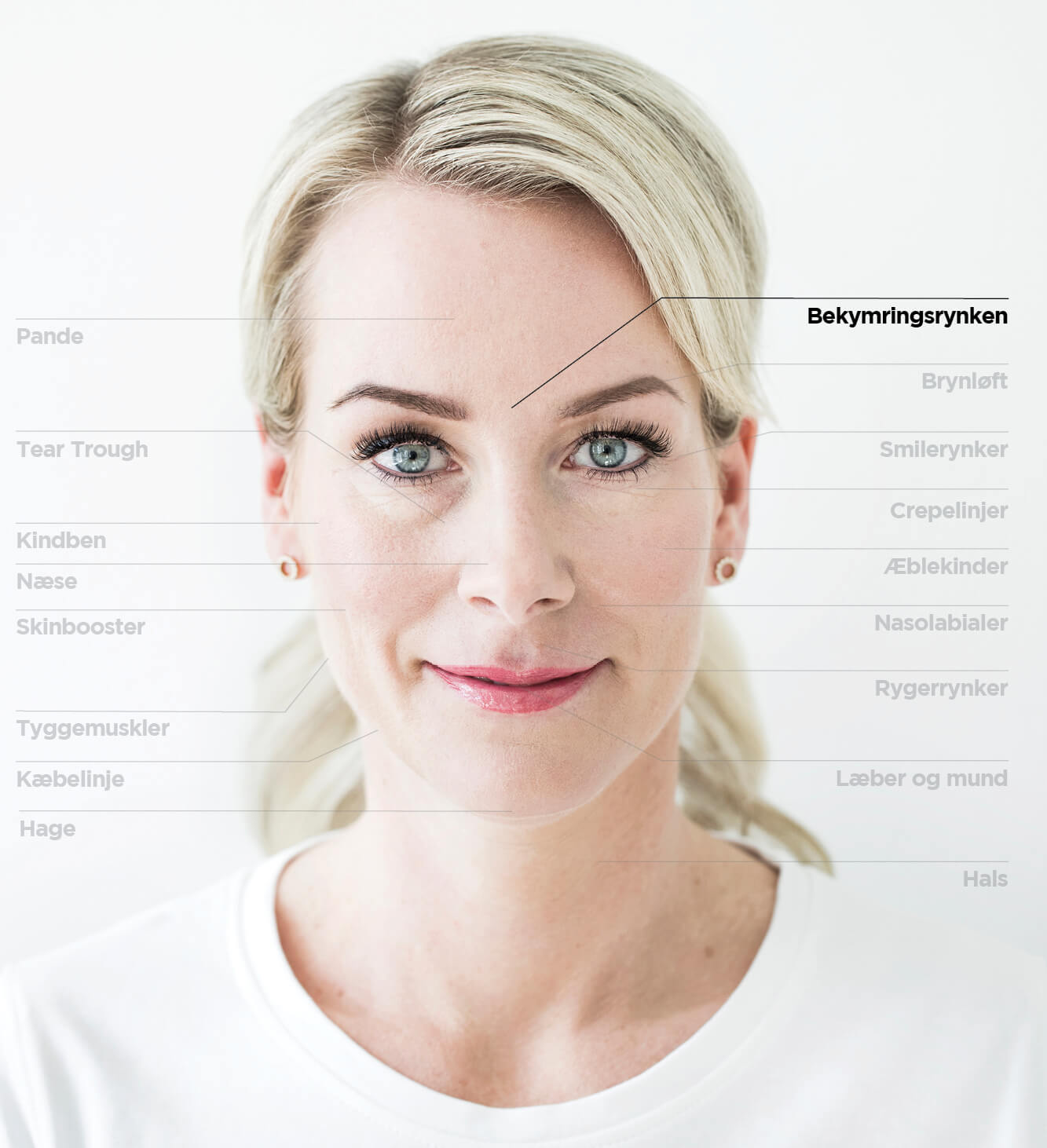 Bekymringsrynke
