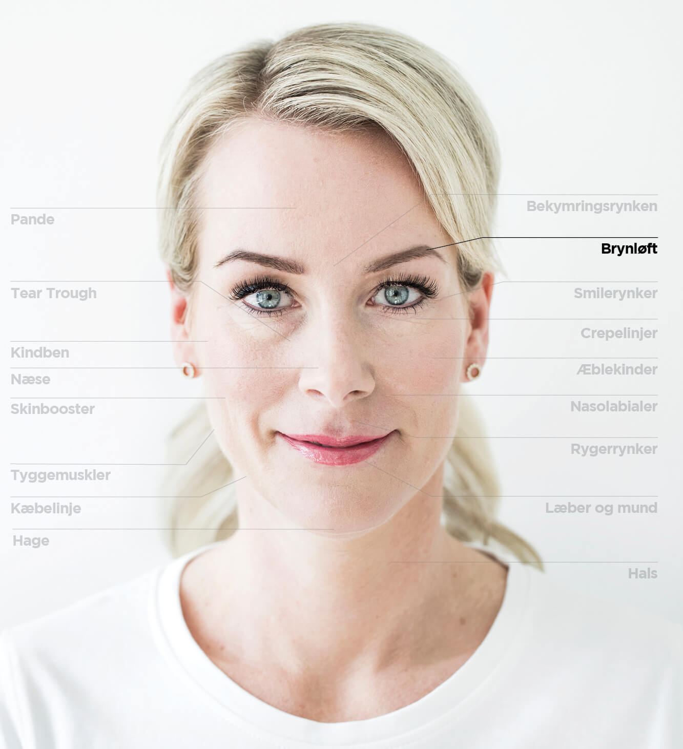 Brynløft
