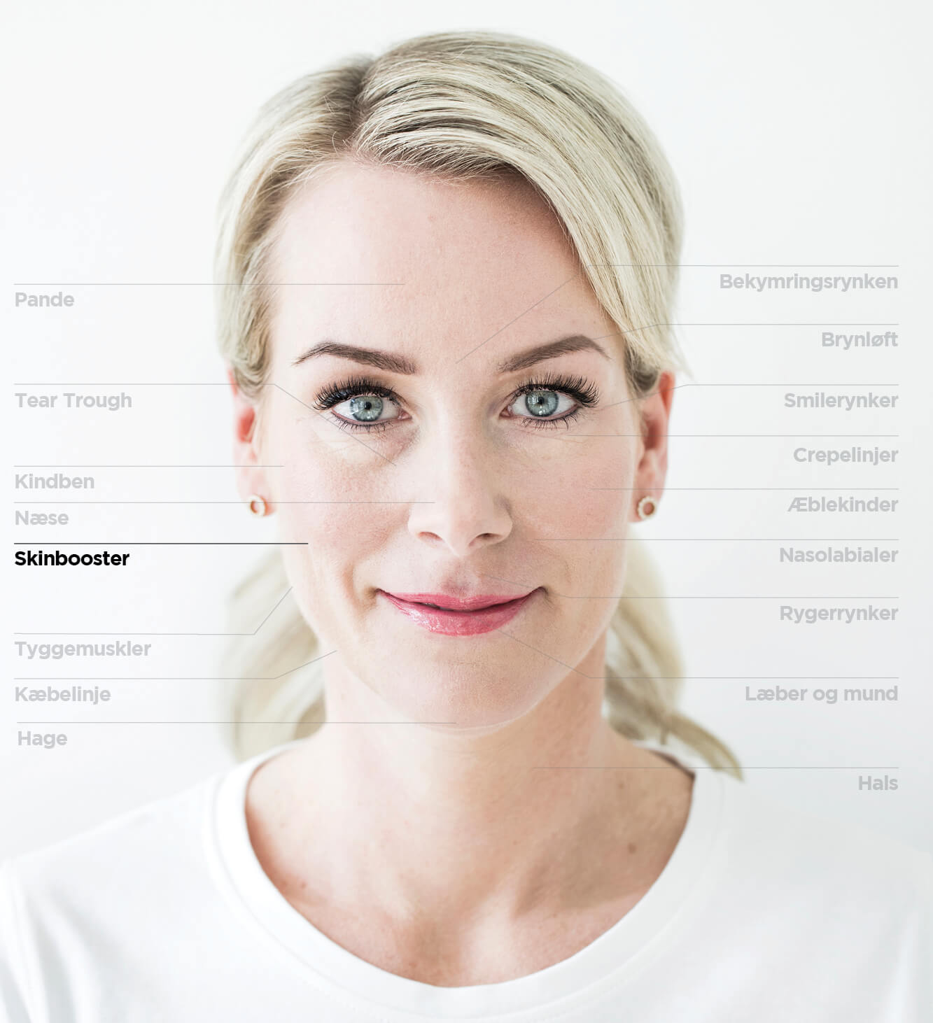 Skinboosters