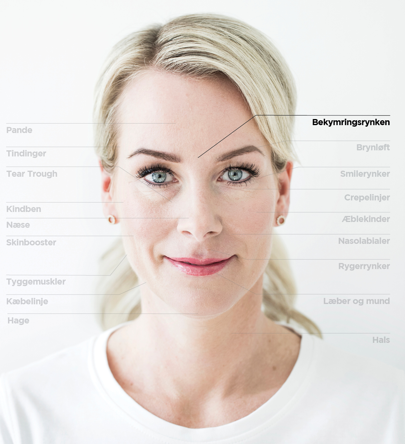 Bekymringsrynke