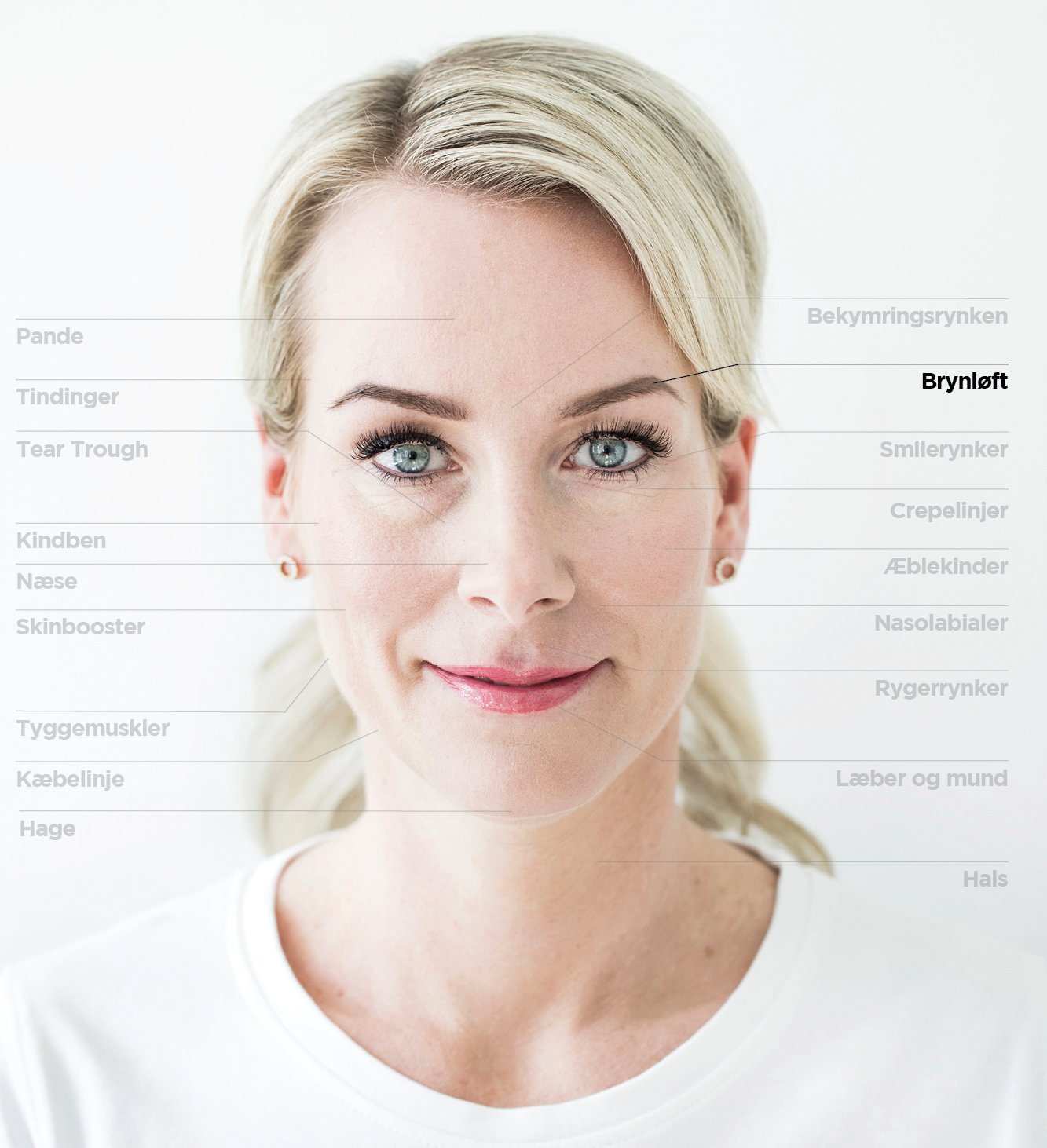 Brynløft