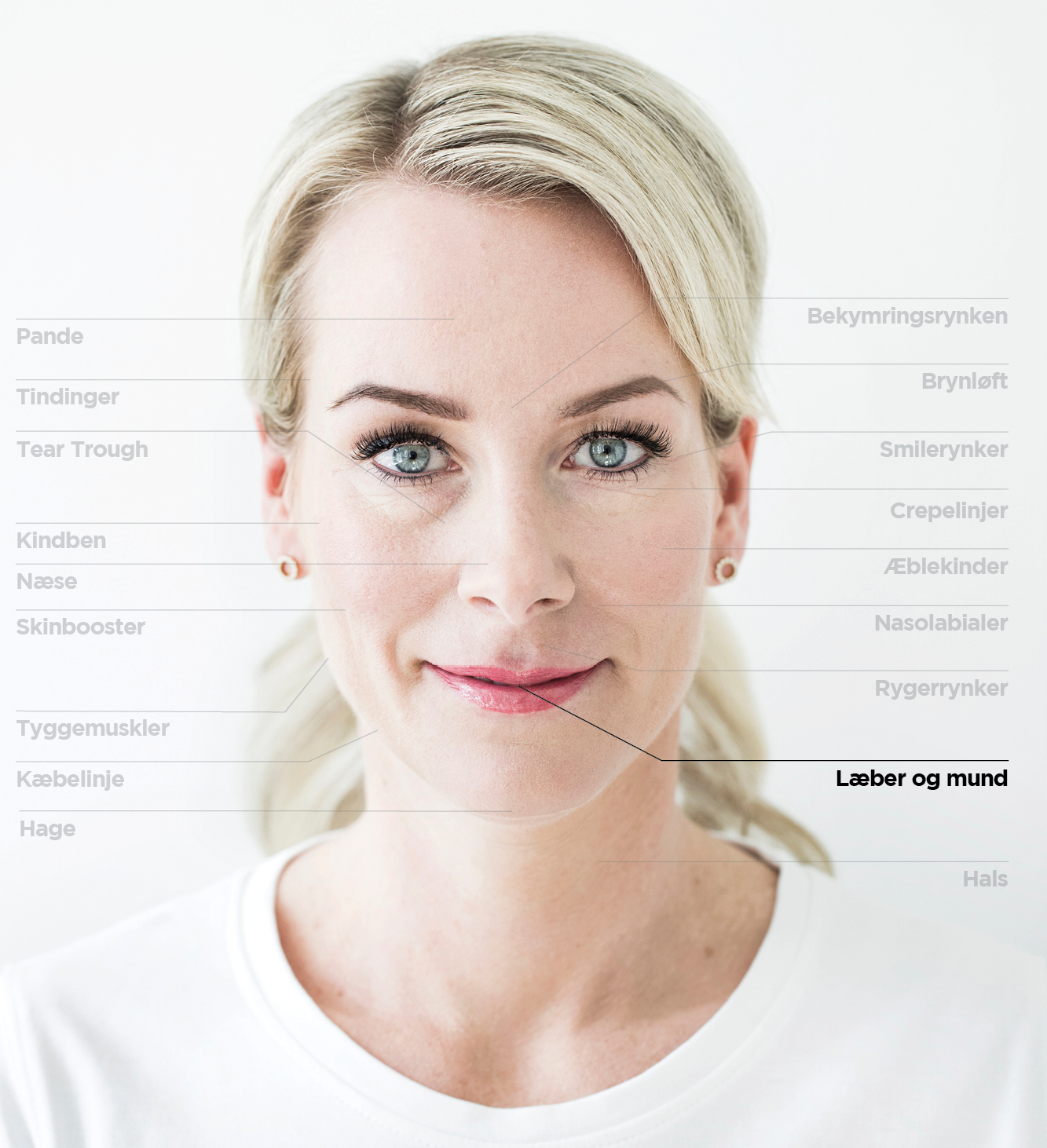 Læbeforstørrelse