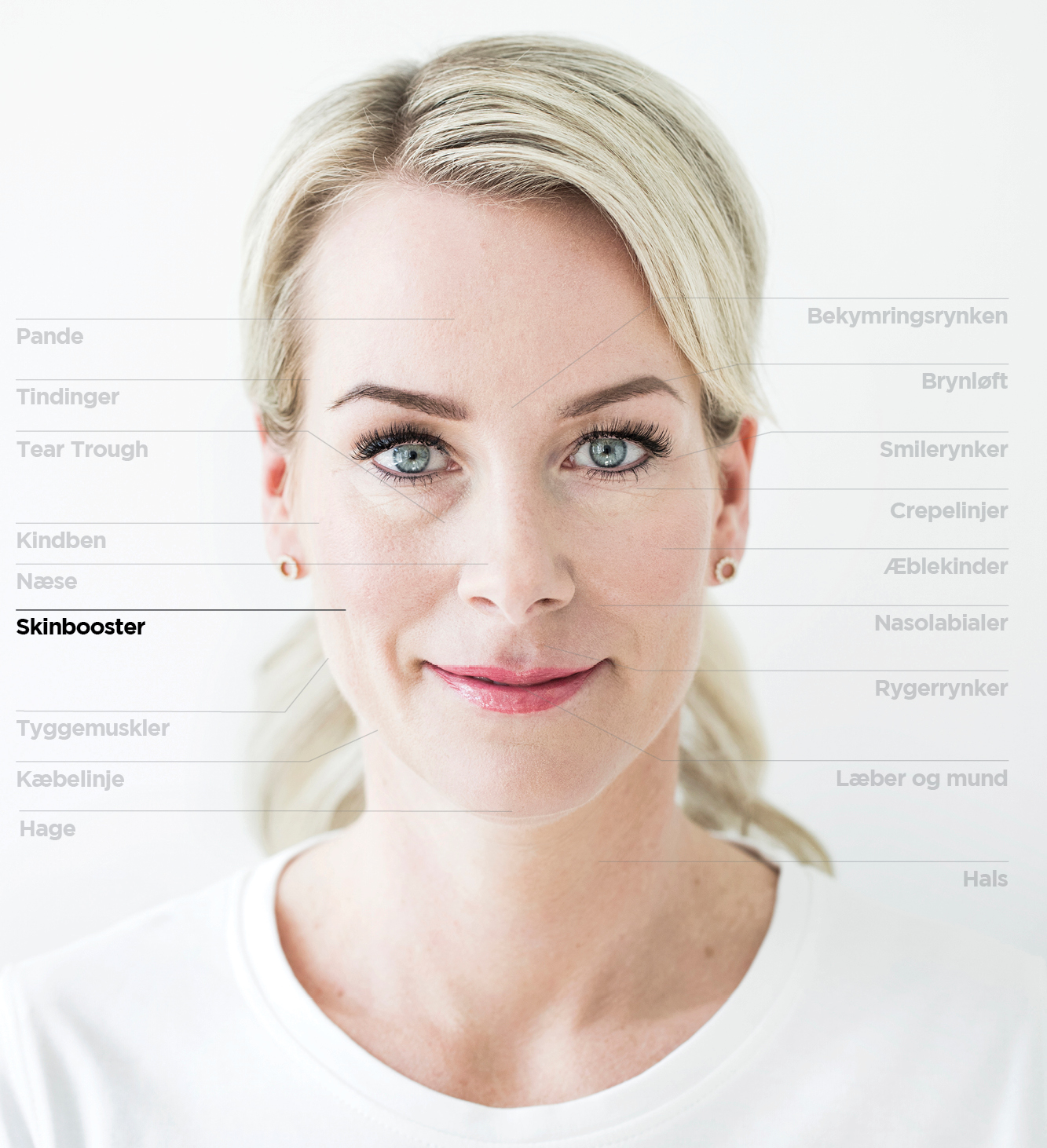 Skinboosters